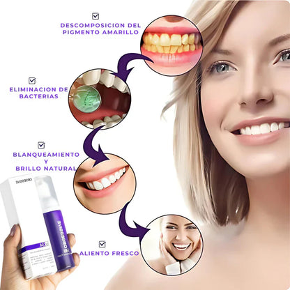 SonrisaOK : Adiós Manchas en los dientes!