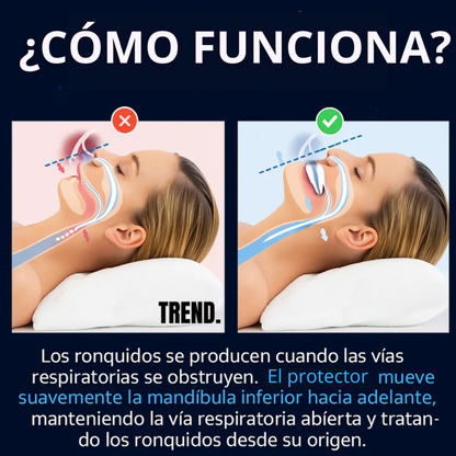 Boquilla Anti Ronquidos – Dormir Sin Ruido – Descanso Tranquilo Desde La Primera Noche!