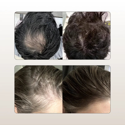 Shampoo Disaar Anticaida - Recupera tu pelo y confianza!