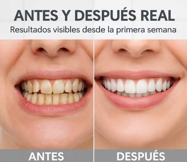 Jet Dental 360°: Dientes y aliento perfecto!