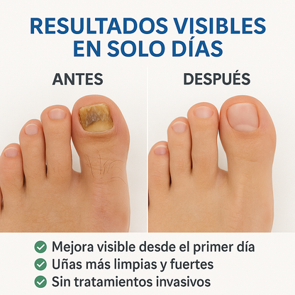 2x1 Parche Antihongos – Tratamiento Directo – Resultados desde el 1er día!