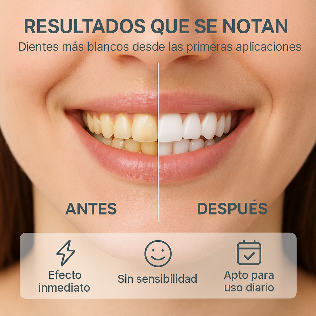 LumiDent : Dientes blancos al instante!