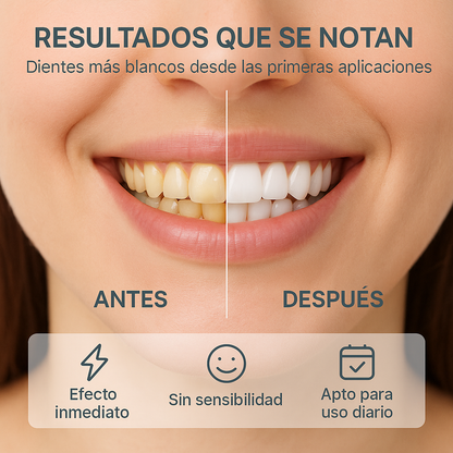 LumiDent : Dientes blancos al instante!