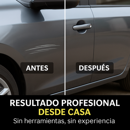 Platinum 20 Sec: Elimina Rayones sin gastar en un Taller!