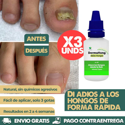 DERMAHONG x3 : Triple acción contra hongos en uñas y piel!